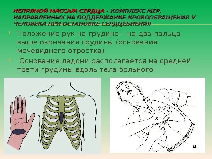 Картинки ПРОДАВЛИВАНИЕ ГРУДИНЫ ПРИ ЗАКРЫТОМ МАССАЖЕ СЕРДЦА
