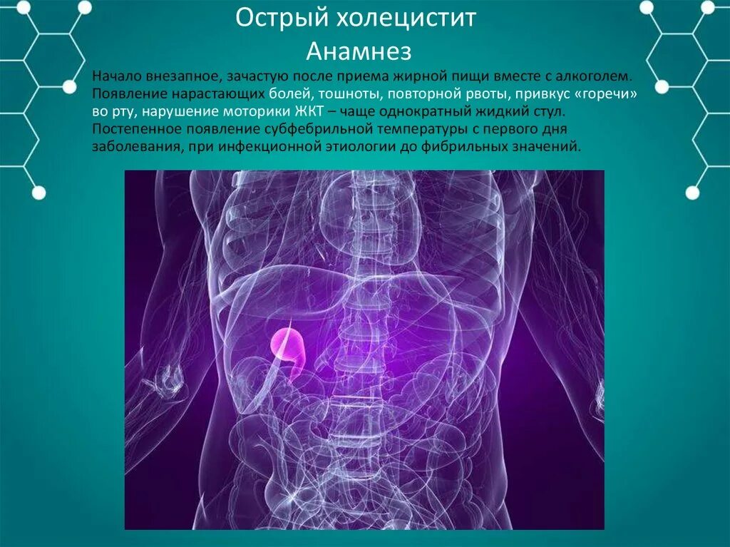 Холецистит анамнез заболевания. Острый холецистит анамнез. Острый бескаменный холецистит мкб. Острый живот анамнез. Хр холецистит код мкб