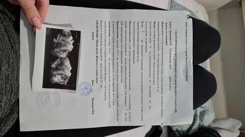 Месячные при приеме