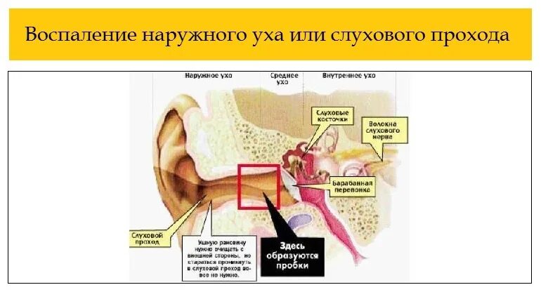 Шум среднего уха. Психосоматика воспаление уха. Воспаление внешнего уха. Воспаление среднего уха. Ушной отит психосоматика.