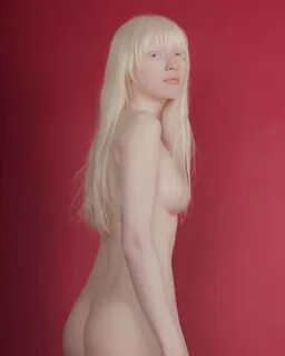 Teen albino naked.