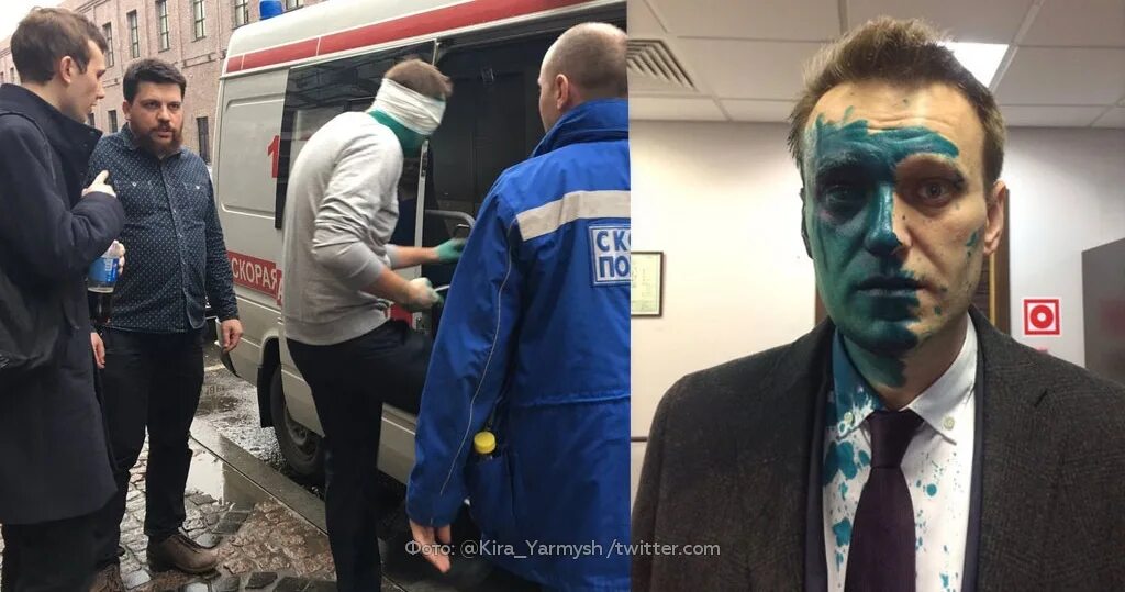 Навального жалко. Навального облили зелёнкой.