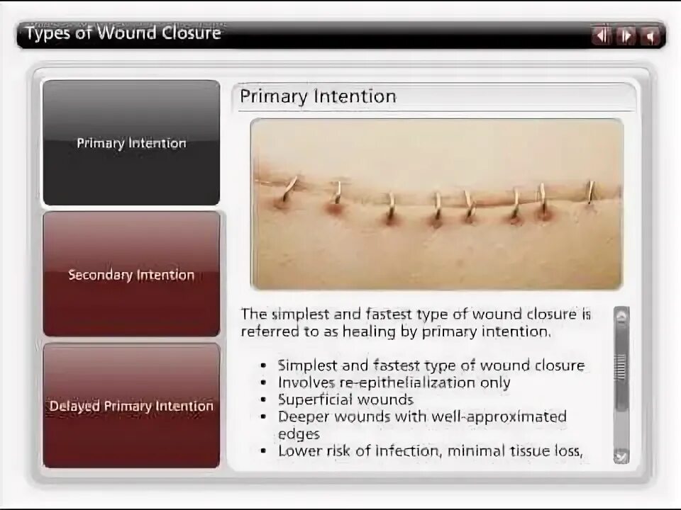 Types of wound. Types of wound