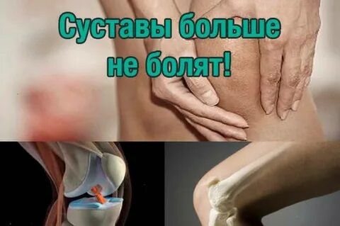 Лечение артроза рецепт