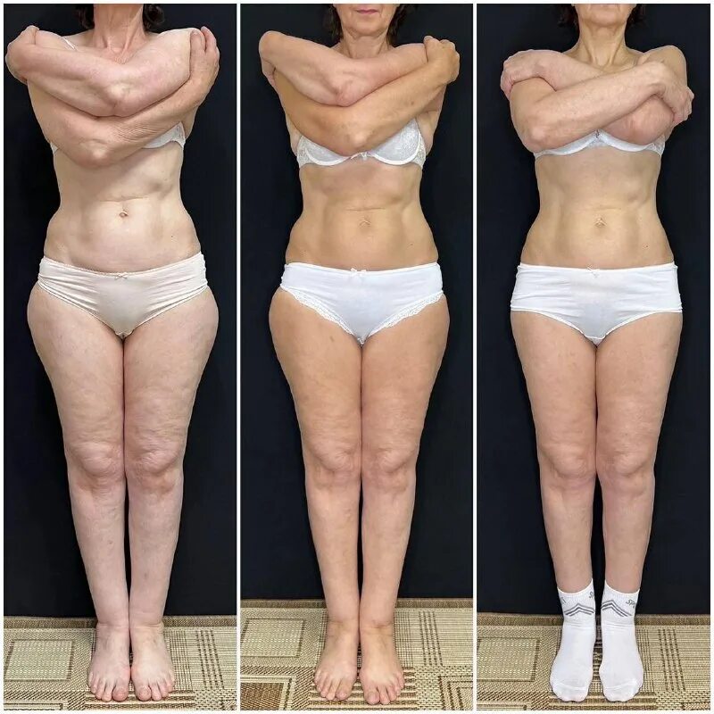 ручную пластику тела