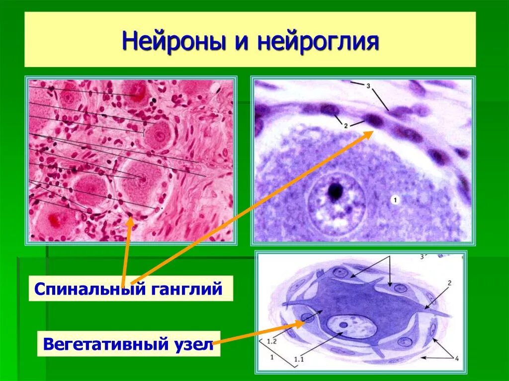 Клетки спинномозгового узла. Нейроглия гистология препарат. Псевдоуниполярный Нейрон гистология. Нервные клетки спинального ганглия. Вегететвиеый и спинальный ганглий.