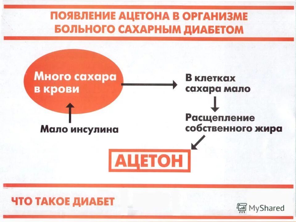 ацетонемический синдром у ребенка. анализ мочи на кетоновые тела. ацетон в моче у ребенка причины. причины повышения ацетона. лекарства при повышении ацетона в моче.