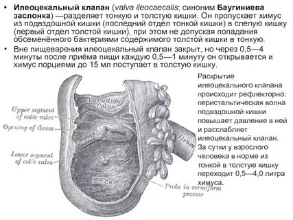 Левая подвздошная кишка