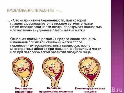 Почему матка низко