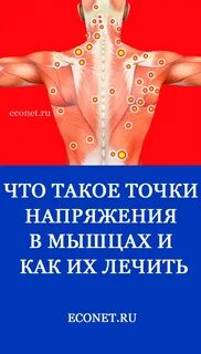 Мышечный невроз