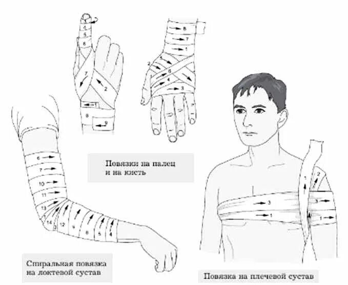 Схема наложения повязки при кровотечении. Схема наложения крестообразной повязки на стопу. Наложение повязки на предплечье. Наложение повязки на голеностопный сустав алгоритм. Повреждение мелких артерий кистей и стоп