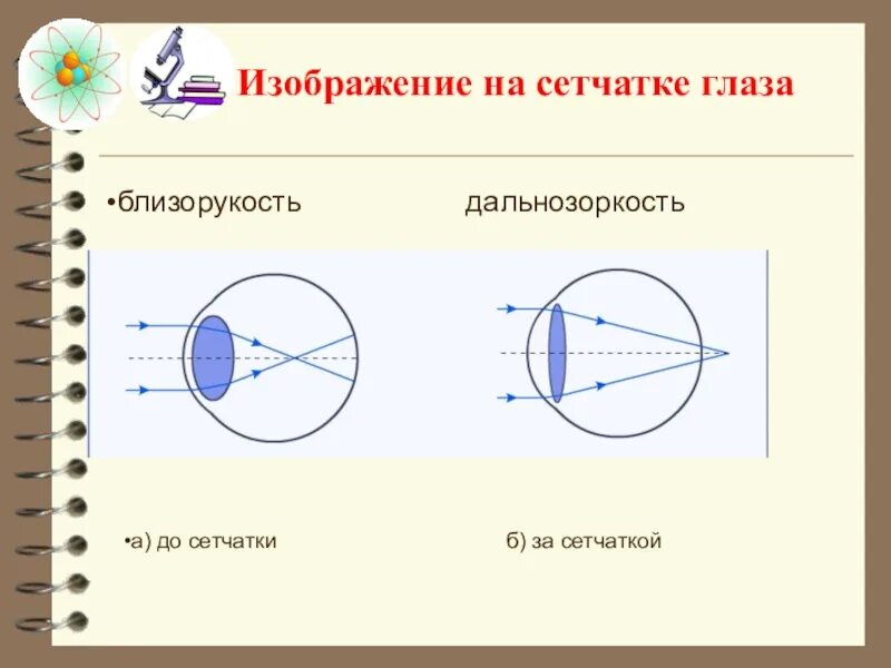 Изображение на сетчатке глаза. Изображение за сетчаткой. Формирование изображения на сетчатке глаза. Изображение за сетчаткой глаза.