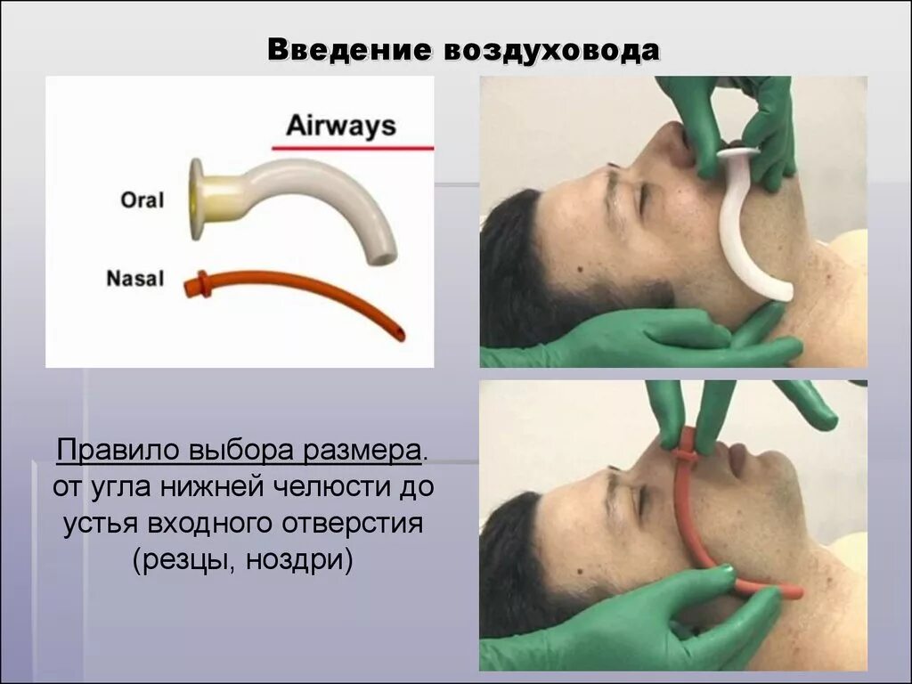 Через рот вводят. Введение урофарингиального воздуховода. Техника введения воздуховода. Введение воздуховода алгоритм.