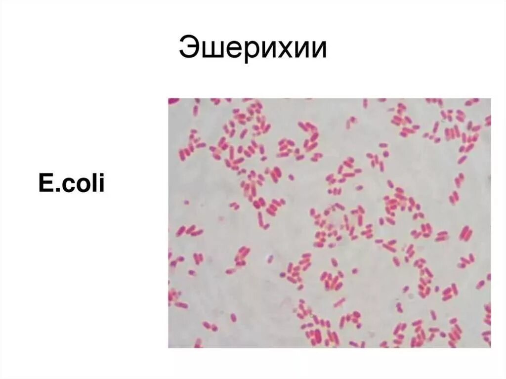 Escherichia coli что это у мужчин. Эшерихия коли микробиология. Эшерихия микробиология. Кишечная палочка эшерихиоз. Эшерихиоз морфология.