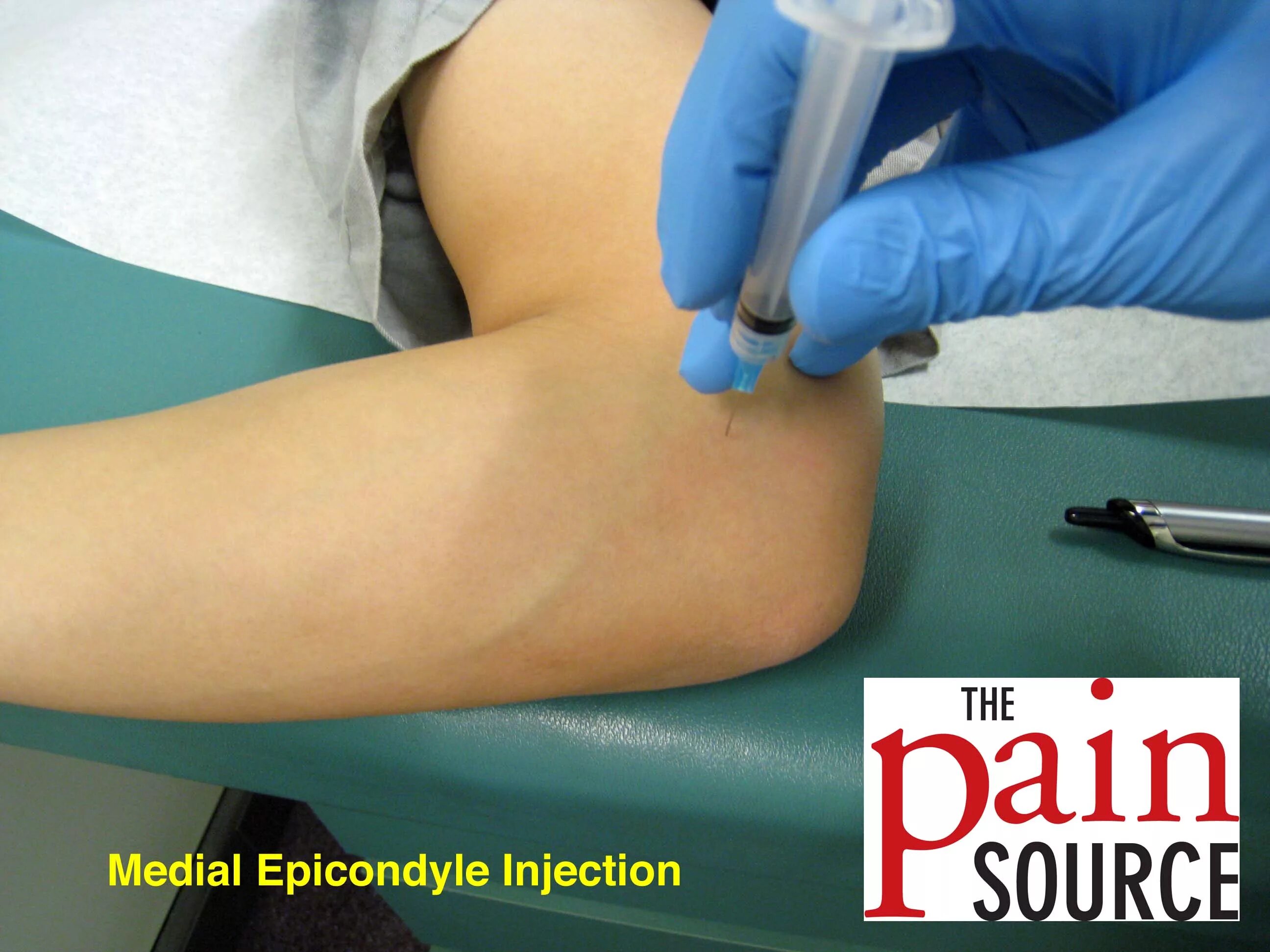 Дренирование локтевого сустава. Пункция локтевого сустава. Укол дипроспана в локтевой сустав. Блокада в локоть. Блокада в локоть.