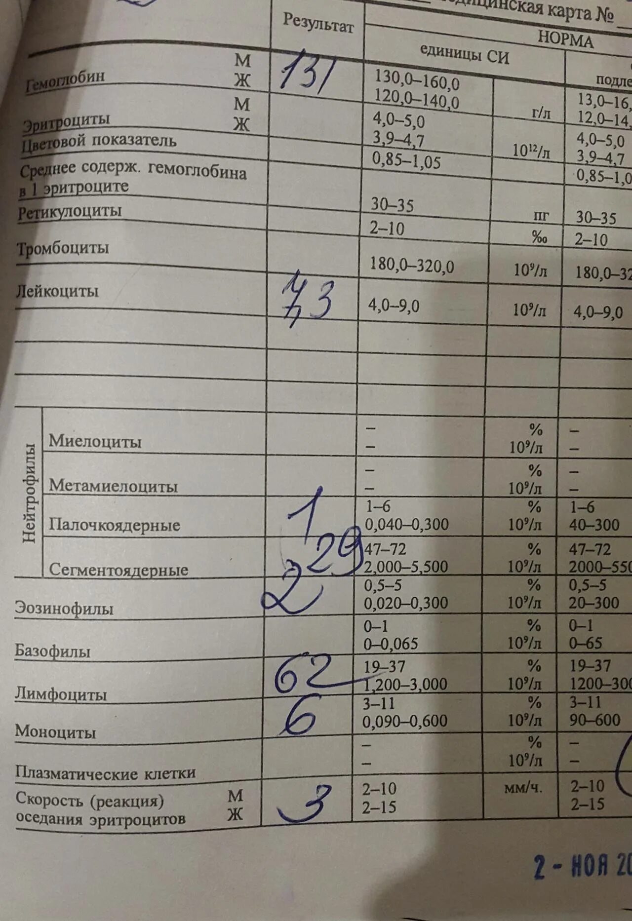 Атипичные мононуклеары в общем анализе крови. Оак мононуклеары. Мононуклеары картина крови. Мононуклеары патогенез. Изменения периферической крови при инфекционном мононуклеозе.