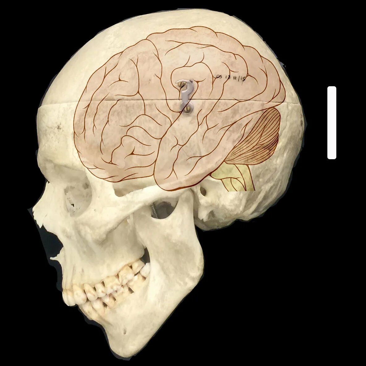 Large brain. Большой мозг. Головной мозг человека в черепе. Череп и мозг человека креативный.