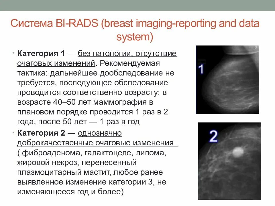 Расшифровка bi rads 2. Birads 2 молочной железы что это такое. Rads 3 молочной железы. Birads 4 молочной железы что это такое. Классификация bi-rads молочных желез в маммографии.