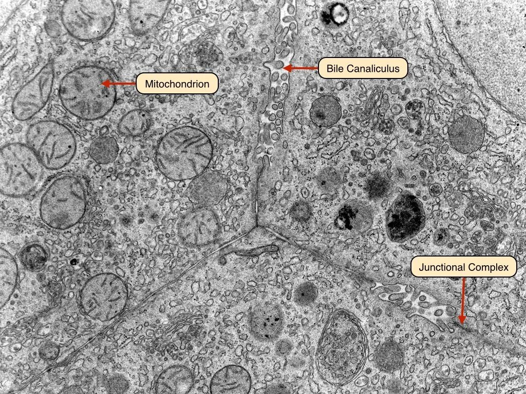 Митохондрии в клетках печени. Митохондрии гепатоцитов. Митохондрия микрофотография. Митохондрия в электронном микроскопе. Хондриосомы в клетках печени.