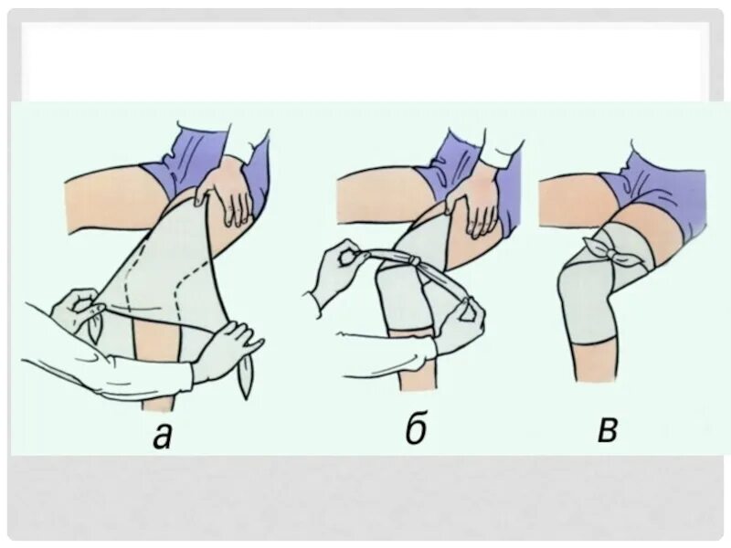 Косыночная повязка на колено. Наложение косыночной повязки на коленный сустав. Косыночная повязка на локоть и коленный сустав. Косыночное бинтование.