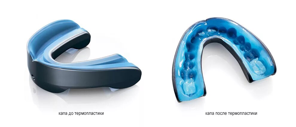 Капа как использовать. 3 Слойная Капа для бокса. Tsp Капа термопластичная Mouthguard (Navy), Jr. Капа Shock Doctor Nano 3d. Капа для кабеля Epke-0084.