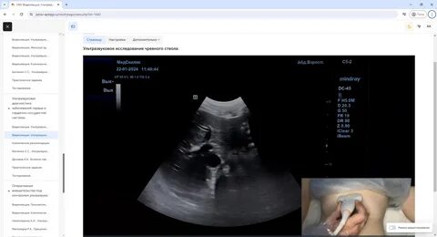Қарт әйелдермен лесбиянкалық порно көру