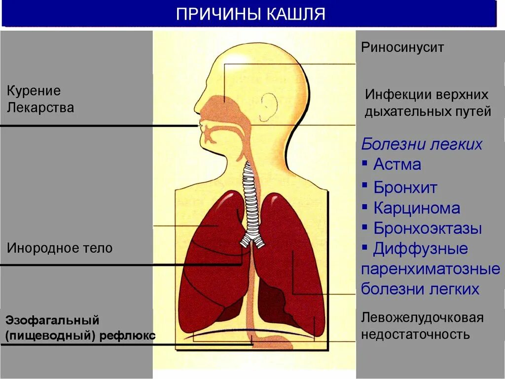 Тест заболевания верхних дыхательных путей. Заболевания верхних дыхательных путей. Заболевания верхних и нижних дыхательных путей. Заболевание верхних дыхательных путей неуточненное. Инфекционные заболевания верхних дыхательных путей.