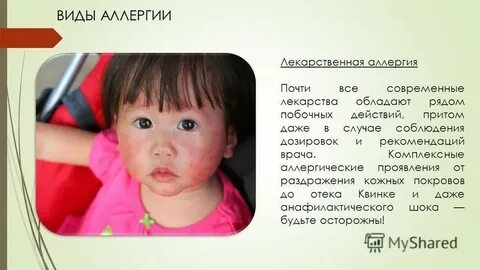 Аллергия на амоксиклав