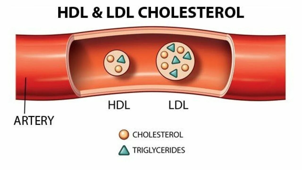 LDL холестерин что это. HDL холестерин что это. ХДЛ холестерол. LDL HDL.