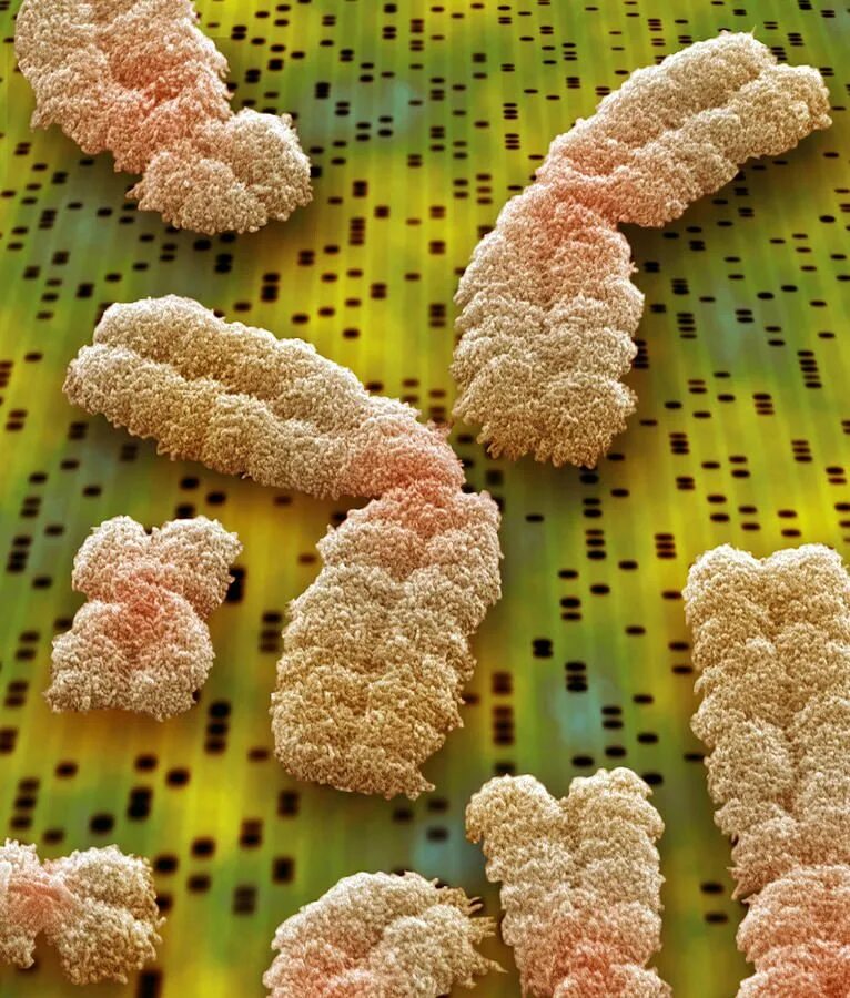 Хромосомы микрофотография. Нить днк под микроскопом. Молекула днк электронный микроскоп. Молекула днк под микроскопом. Микрофотография днк.