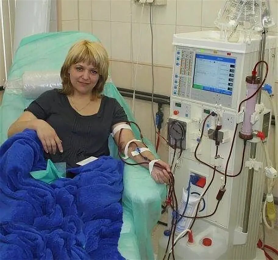 Пациент с хпн. Аппарат искусственная почка. пациент с хронической почечной недостаточностью. больной с почечной недостаточностью.