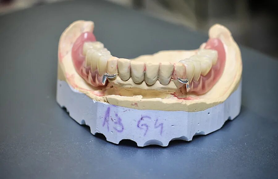 Съемный пластиночный протез показания