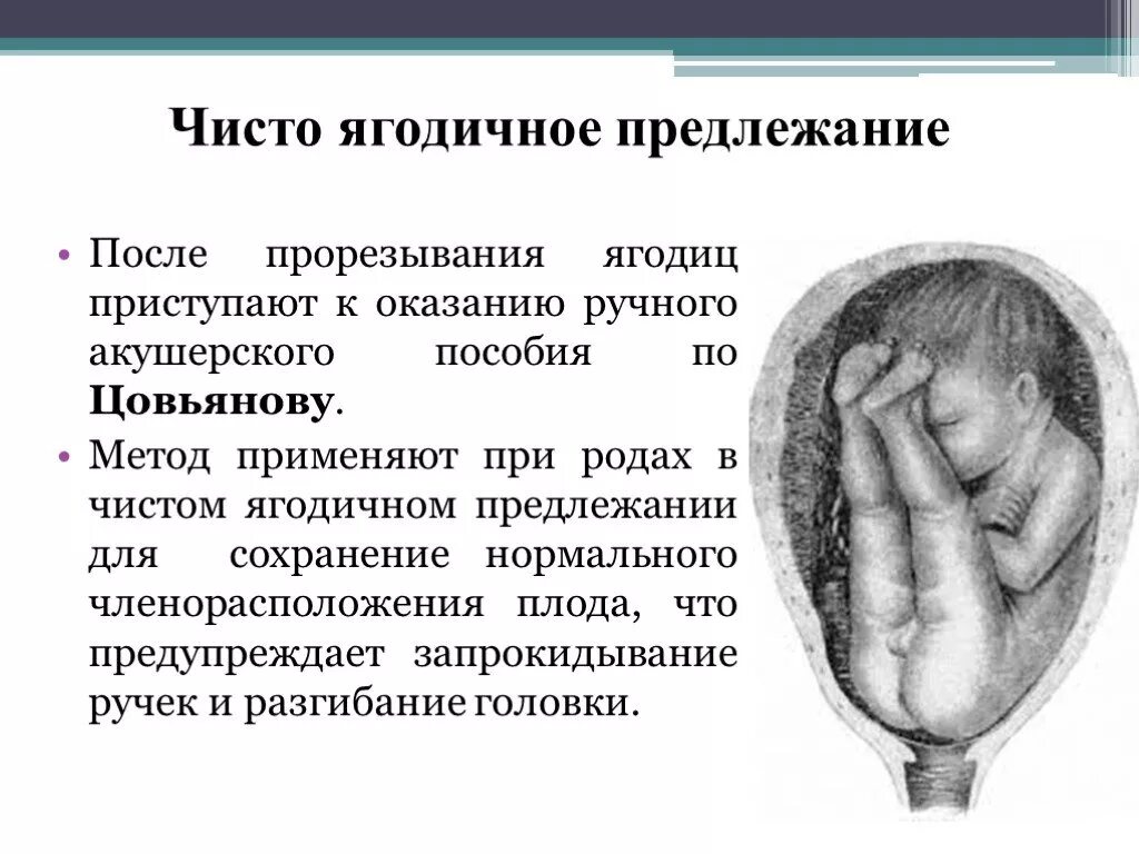 Тазовое предлежание показание. Головное предлежание плода на 20 неделе. Чисто ягодичное предлежание плода роды. Головное предлежание плода на 34 неделе беременности. Головное предлежание плода на 32 неделе.