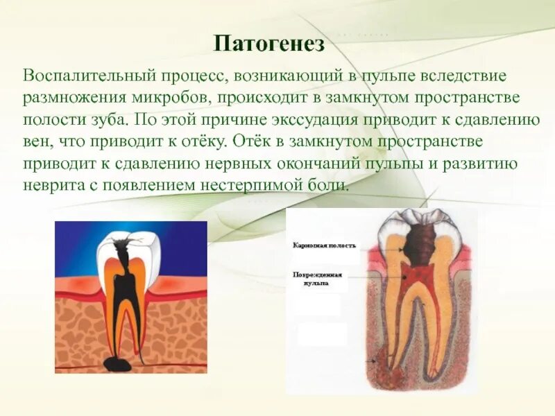 Тест на воспалительный процесс