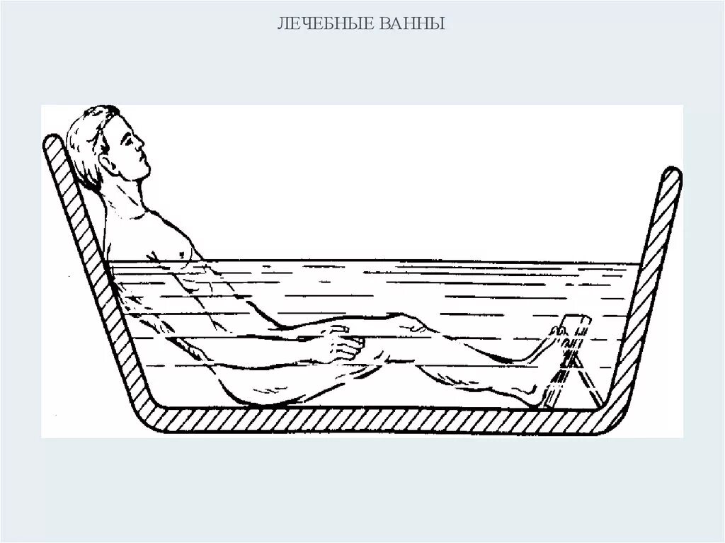 Проведение лечебной ванны алгоритм