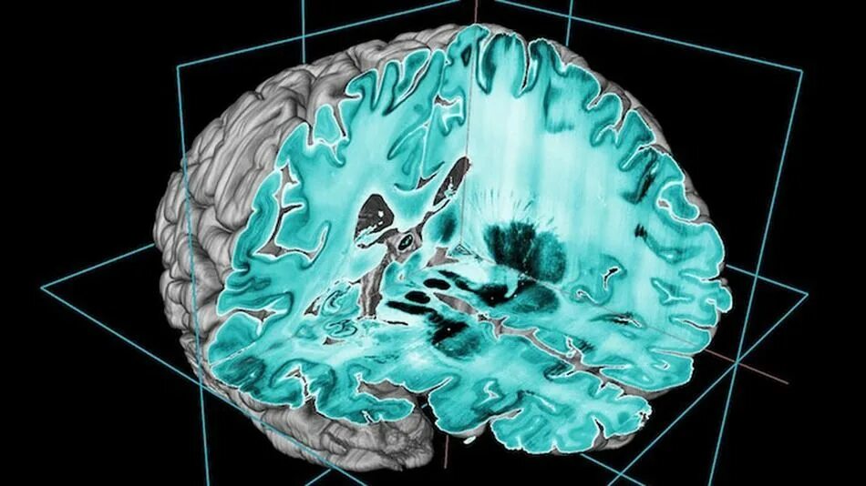 Re brains. Трехмерная модель головного мозга. Моделирование головного мозга.