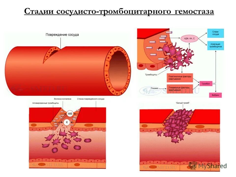 Разрыв среды. Сосудисто-тромбоцитарный гемостаз этапы. Сосудисто-тромбоцитарный гемостаз механизм. Этапы тромбоцитарно-сосудистого гемостаза. Гемостаз механизмы свертывания крови.