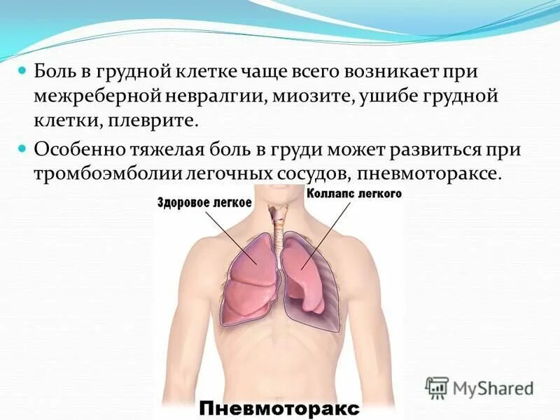 Кашель болит с правой стороны. Дискомфорт в середине грудной клетки. Ломота в грудной клетке посередине. Ноющие боли в грудной клетке.