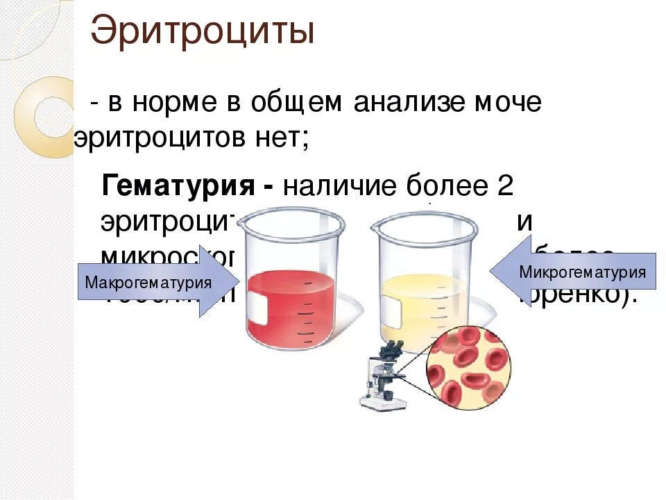 Почему повышены эритроциты в моче. Микрогематурия норма эритроцитов в моче. Гематурия показатели ОАМ. Общий анализ мочи норма эритроцитов в моче. Показатели анализа мочи эритроциты.