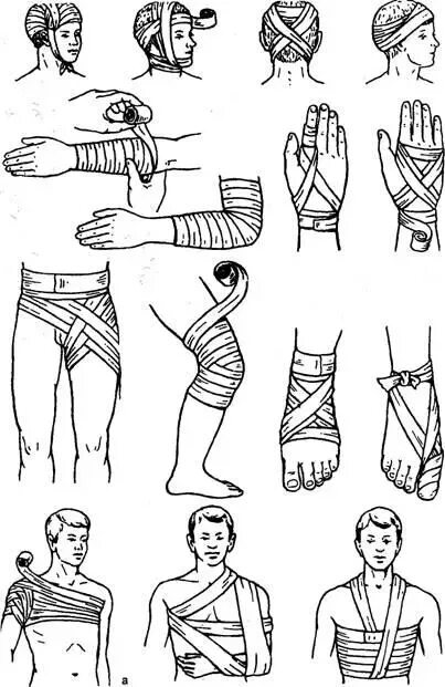 Правила и техника наложения повязок. Десмургия техника наложения повязок. Способы наложения бинтовых повязок. Десмургия типы повязок. Десмургия алгоритм наложения повязок.