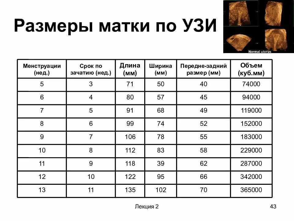 4 65 2 63. Размеры матки в норме по УЗИ. Таблица объема матки по УЗИ. Нормальный объем матки по УЗИ. Нормальные Размеры матки по УЗИ В мм.