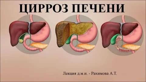 Лекция печень