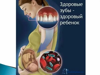 Рта беременности