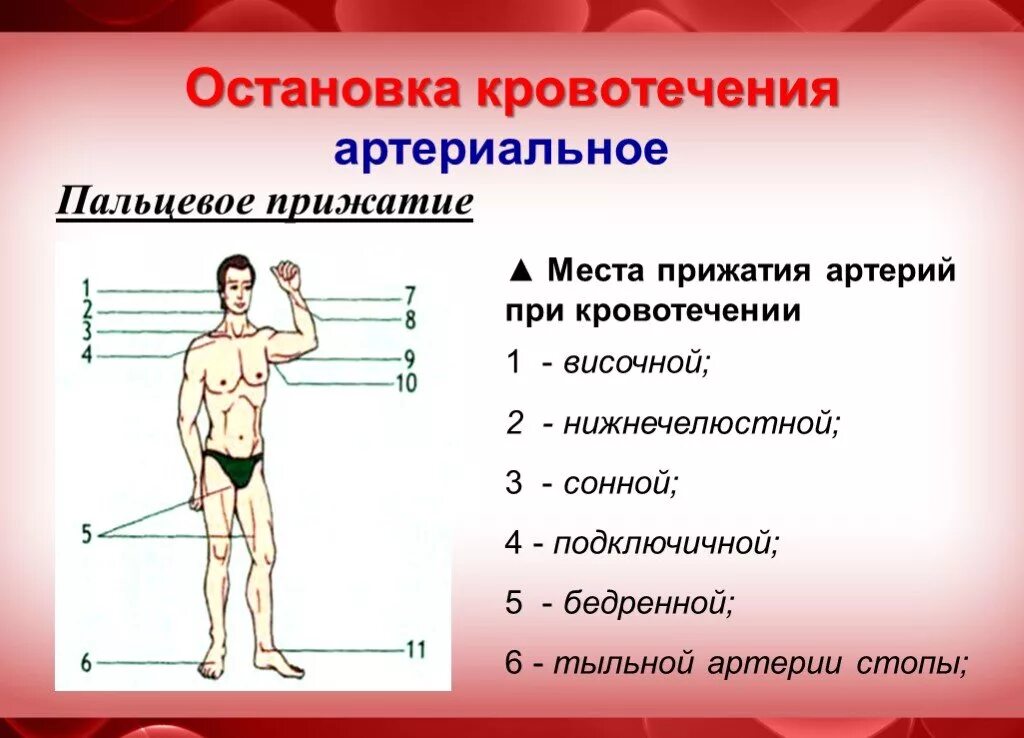 Способы остановки кровотечения пальцевое прижатие артерии. Остановка кровотечения методом пальцевого прижатия. Места прижатия артерий при кровотечениях. Пальцевое прижатие подключичной артерии. Пальцевое прижатие артерий алгоритм.