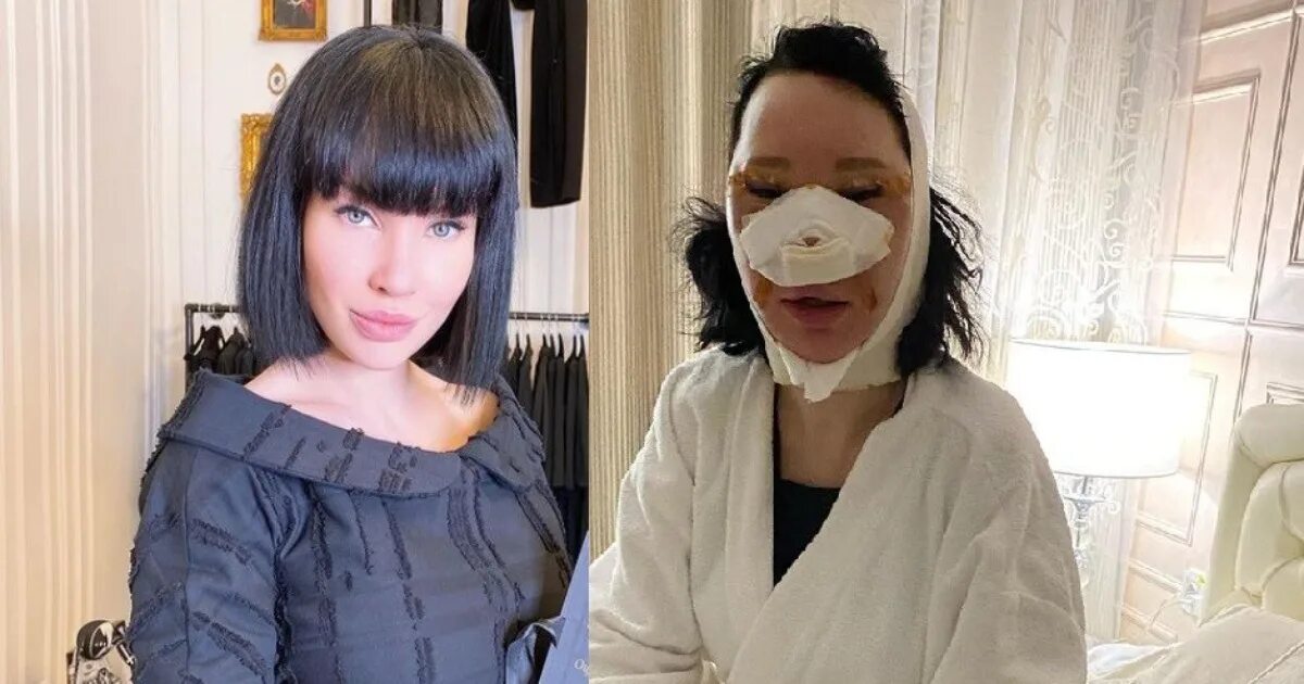 Звезда "Битвы экстрасенсов" Ольга Якубович испугала кадрами после пластических о