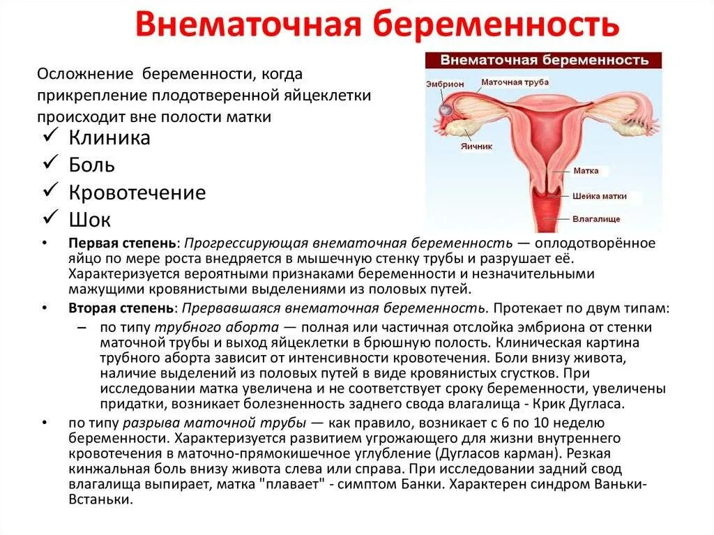 Если внематочная беременность. Матка внематочная беременность. Беременность в маточной трубе. Осложнения внематочной беременности. Кровотечение тянет живот