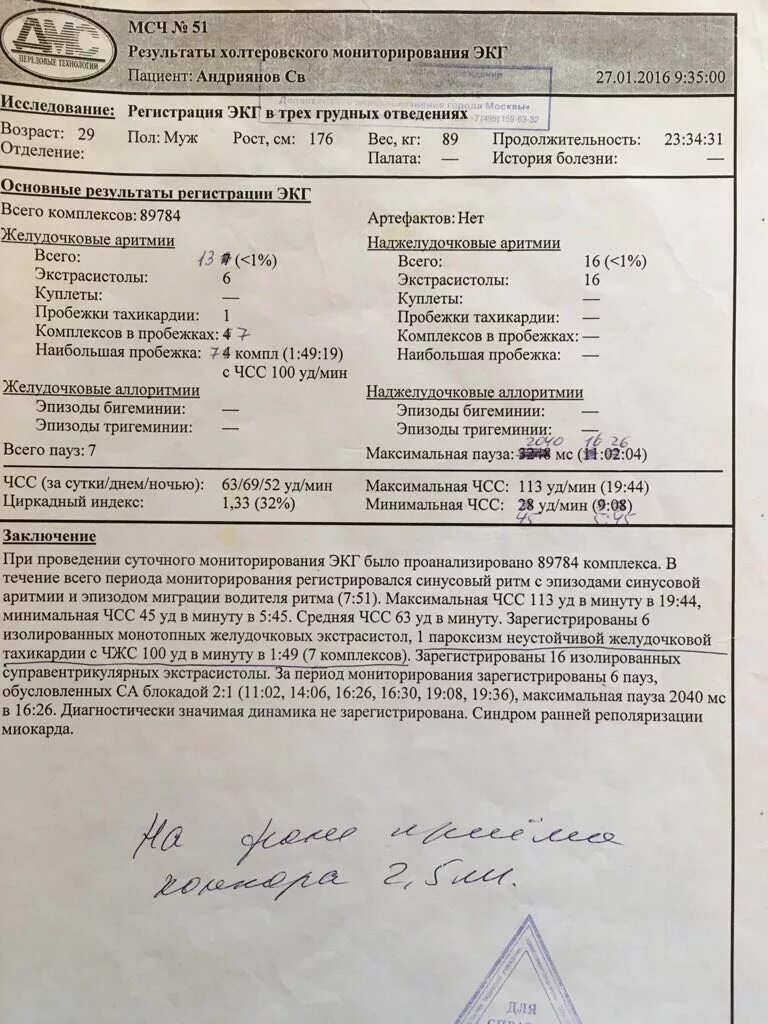 Сколько дней холтер. Заключение по экг. холтер экг заключение. холтеровско мониторирование экг закл. холтеровское мониторирование экг заключение.