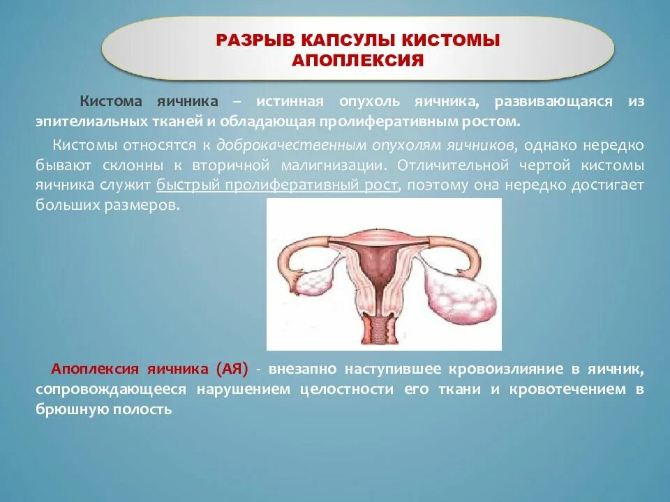 Разрыв капсулы опухоли яичника. Разрыв яичника апоплексия.