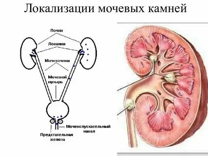 Исследование конкремента
