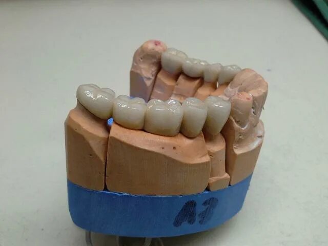 форма зубов для зубных техников. форум зубных техников. зуботехническая лаборатория «метрика». японские зубные техники. форум зубных техников.